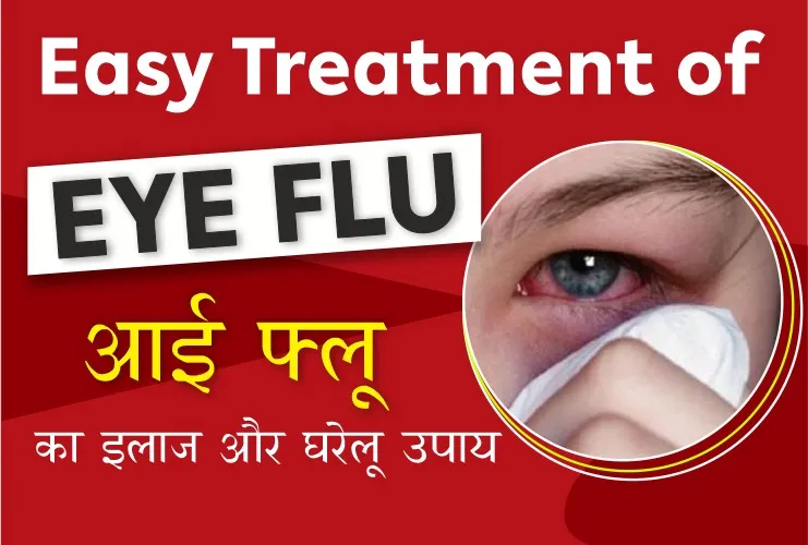 Easy Treatment Of Eye Flu
